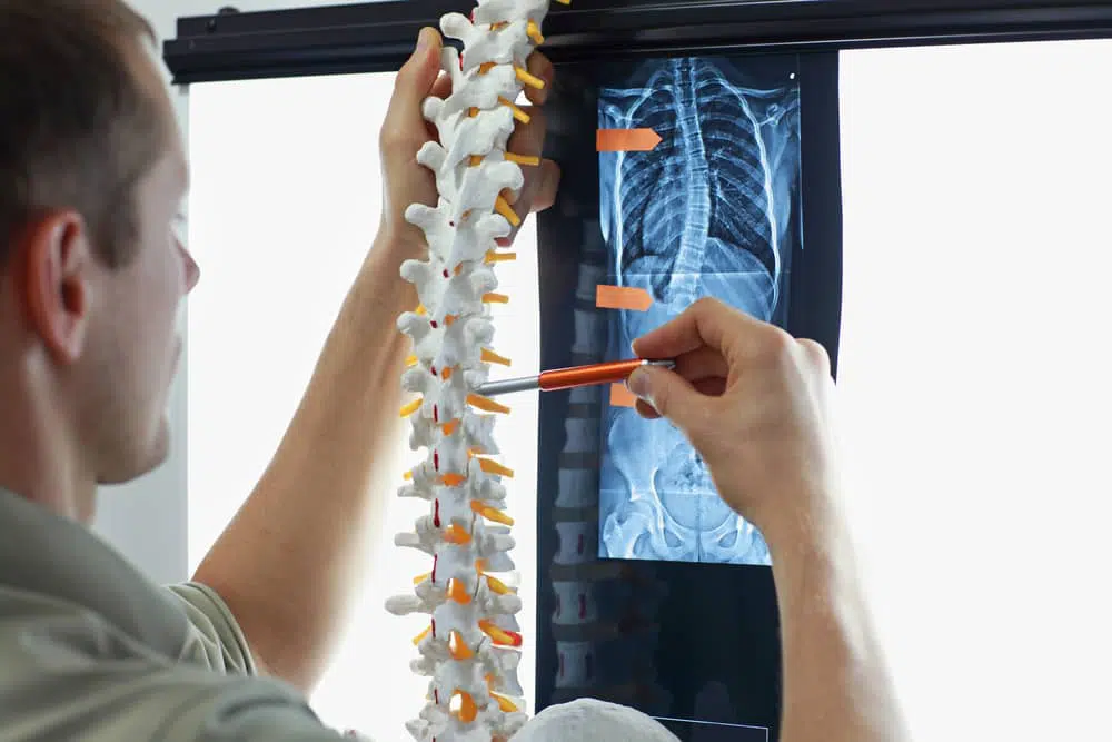 Doctor looking at a spine figure to study pinched nerves.