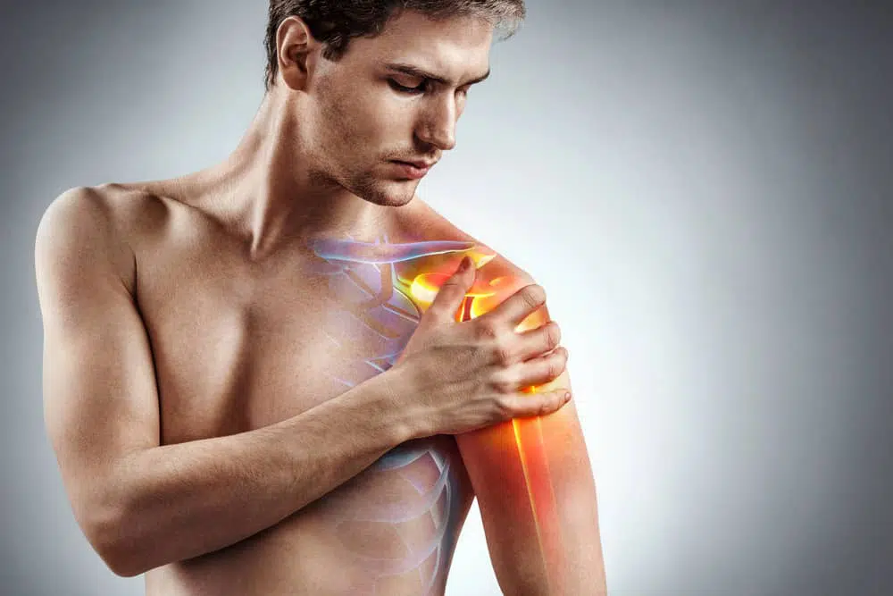 Why Chiropractic Care is a Great Choice for Rotator Cuff Tendinitis