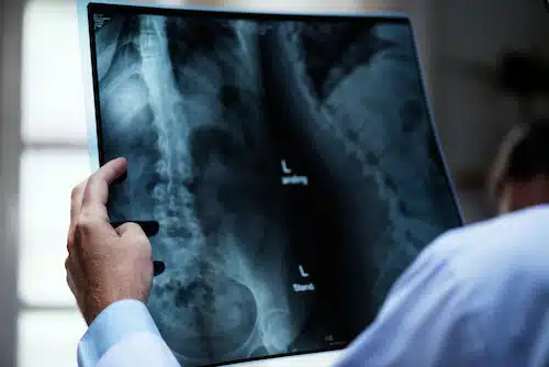 doctor looking at xray images of patient